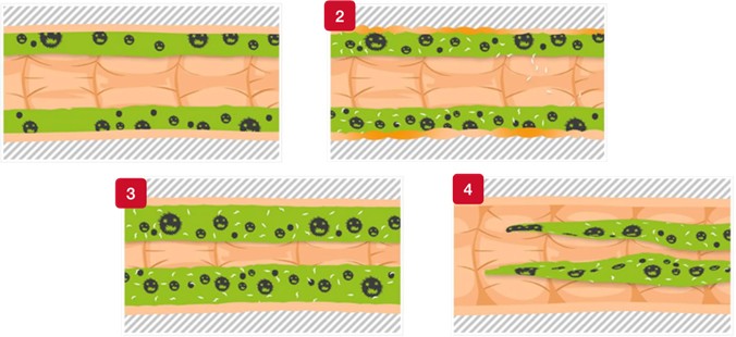 biofilm3